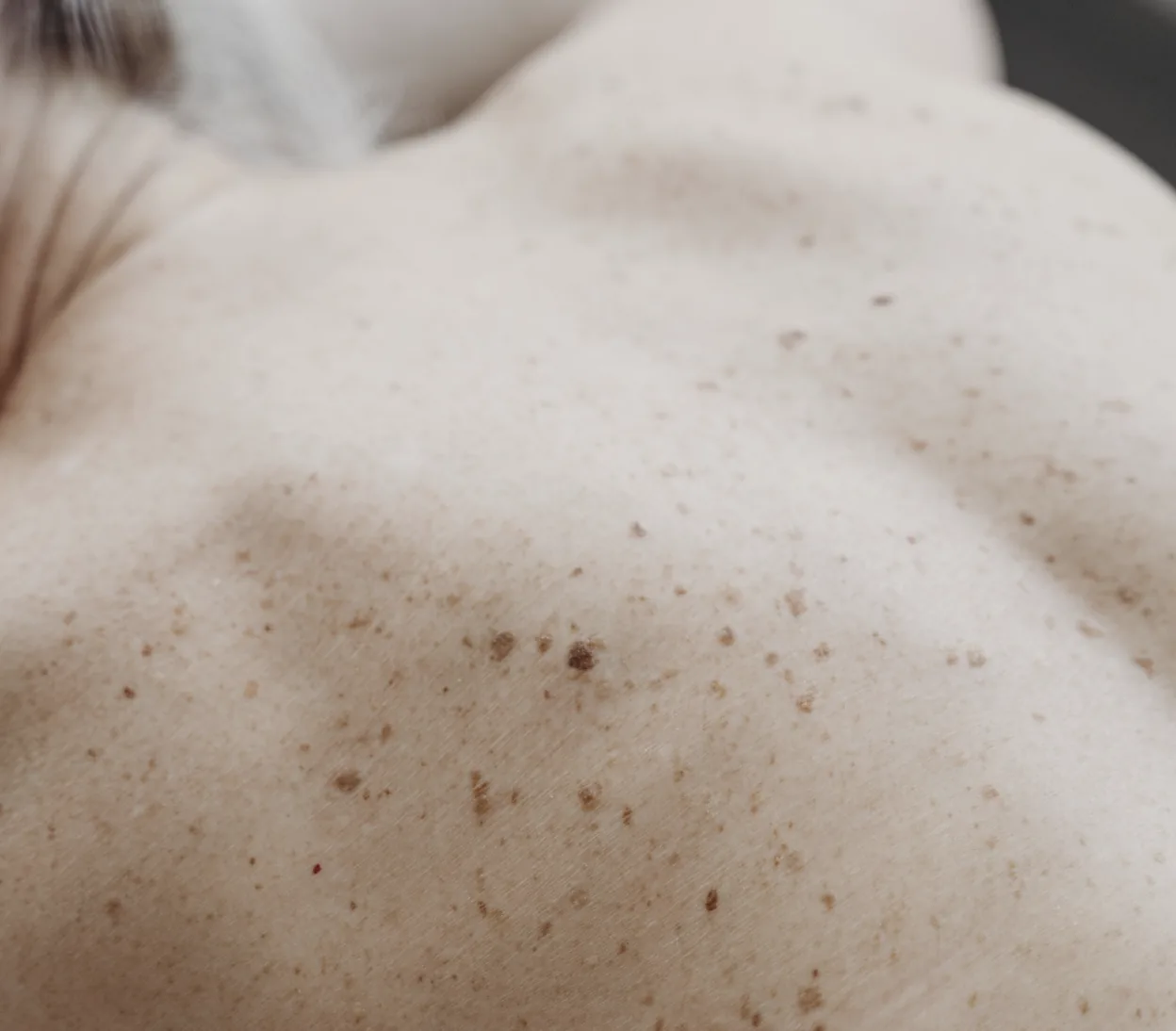 Close-up of natural freckles and pigmentation across the skin.